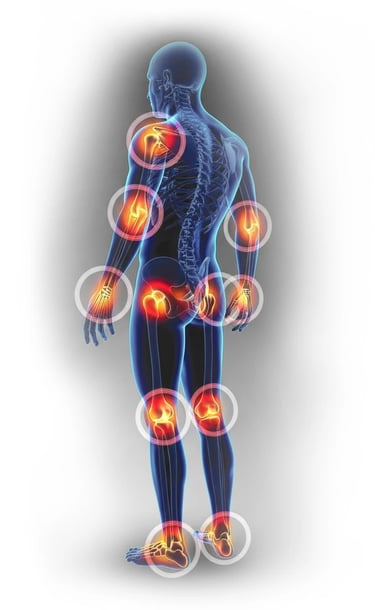 Anatomical 3D illustration showing joint pain and inflammation in a human body's skeletal system.