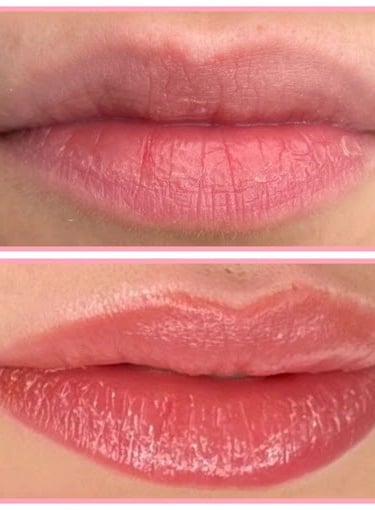 Permanent Make-up Lippen Vorher Nachher Fotos Lippenpigmentierung Lip Blush