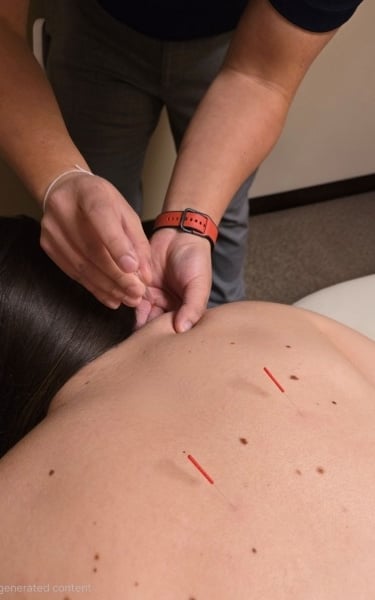 Dr. Xiong performing acupuncture on the shoulder to release neck/shoulder tension. 