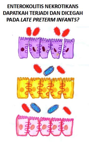 diagram enterokolitis nekrotikans