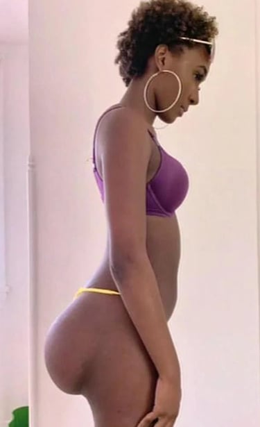 butt implants on a woman side view