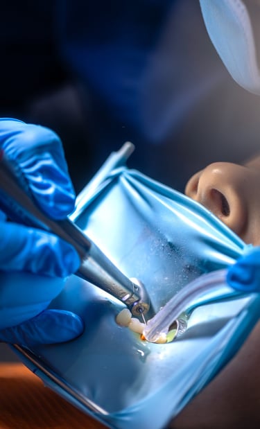 Procedimiento de endodoncia con tecnología especializada en DUPRINS Lima - Tratamiento de conducto
