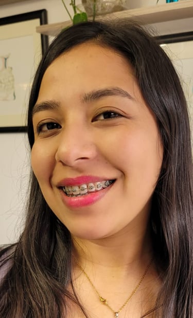 Sonrisa perfecta después de ortodoncia en DUPRINS Lima - Brackets y alineadores dentales