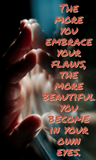 "The more you embrace your flaws, the more beautiful you become in your own eyes" Feel good stories