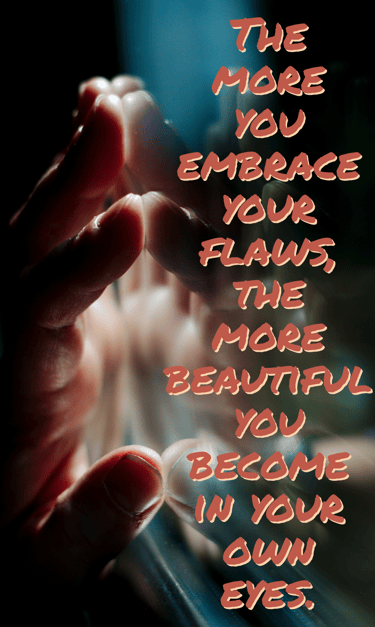 "The more you embrace your flaws, the more beautiful you become in your own eyes" Feel good stories