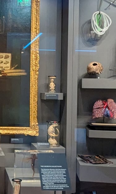 A case in the Hunterian Museum, London.