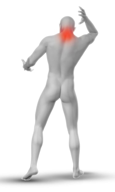 mannequin avec douleur dans la nuque