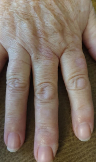 Close-up of an elderly person's hand showing skin texture, age spots, and wrinkles.