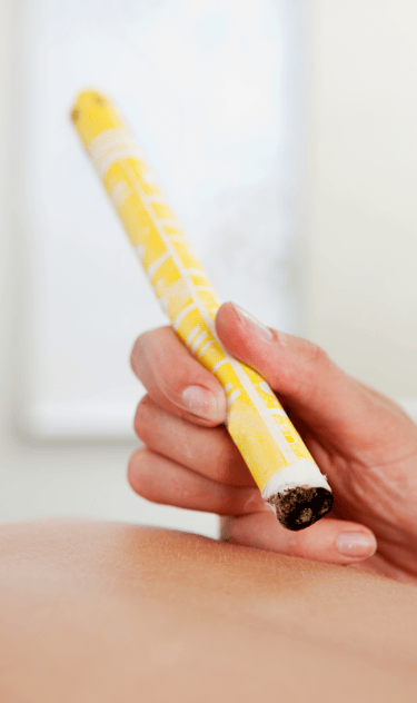 Séance de médecine chinoise, pratique du Moxa