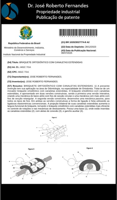 O aparelho ortodôntico mais eficiente é o Arquimedes System do Dr. José Roberto Fernandes