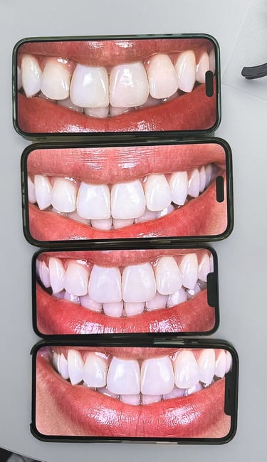 mobile dental photography comparison