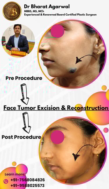 Face plastic Surgery in udaipur.