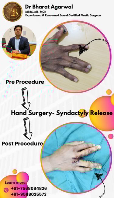 Hand and Microvascular Surgery in udaipur.