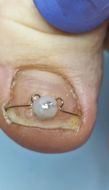 iauges nagas korekcija