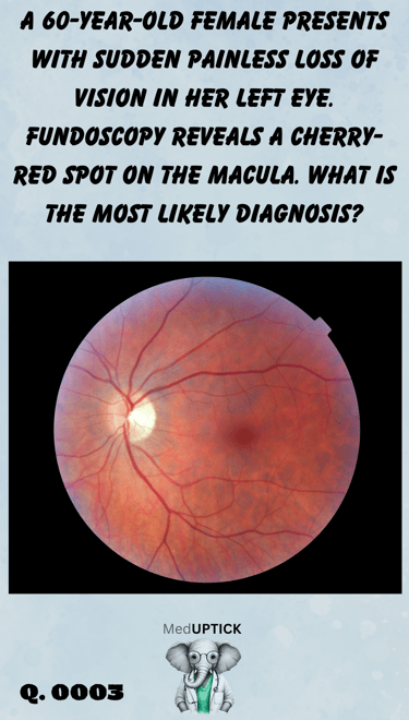 fundoscopy image of a cherry red spot