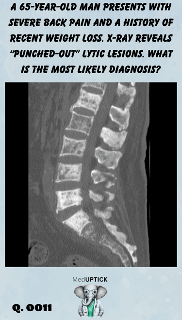 MRI imaging showing punch our lesions of the tailbone of the spine