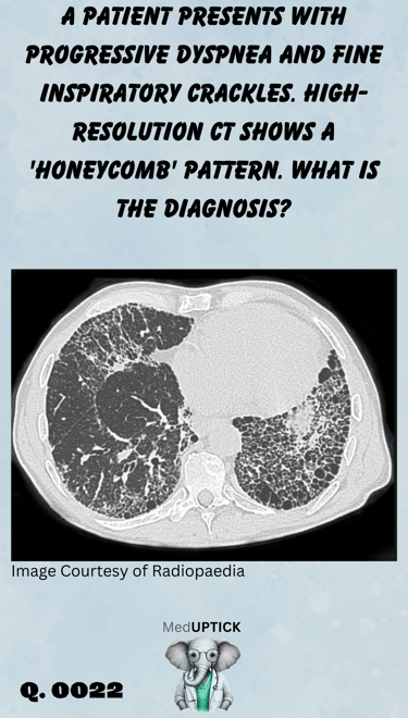 a CT scan demonstrating a 'honeycomb' lung pattern
