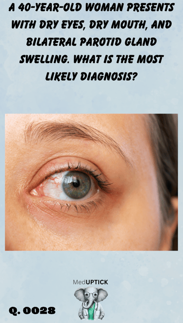 a close-up of a female's eye demonstrating redness and irritation of the sclera