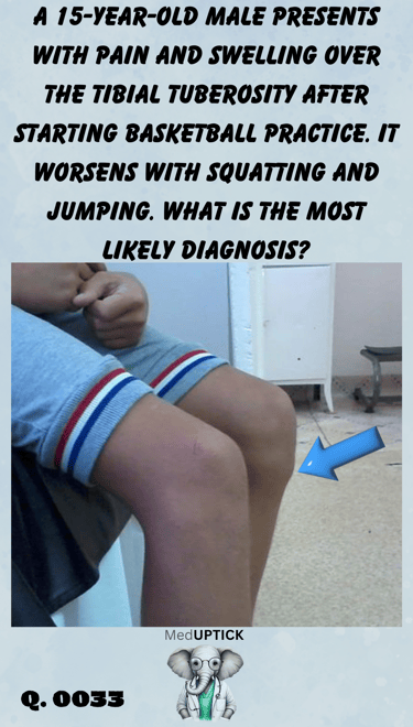 a blue arrow pointing to the knee of a patient with swelling over a tibial tuberosity 