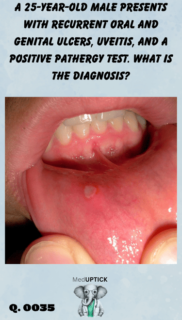 a close-up of an oral ulcer
