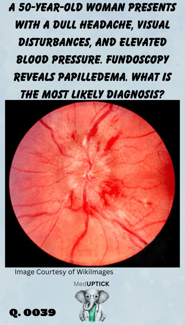 a close up fundoscopy image demonstrating papilledema
