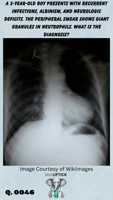 an x-ray of a child with a boot-shaped heart