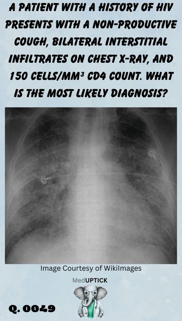 a chest x-ray with bilateral infiltrates