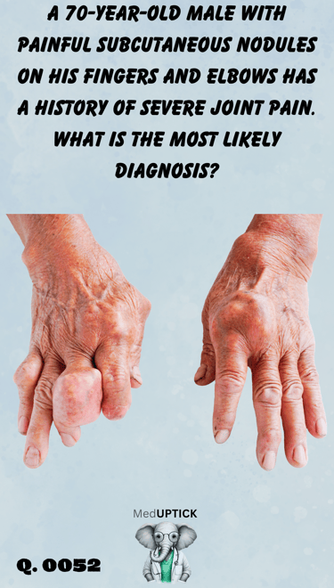 a close up of an elderly patients hands with disfigurement and joint masses
