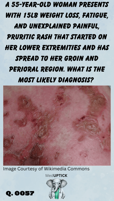a close up image of a red, blotchy, itchy, and painful skin rash