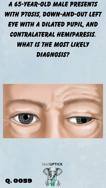 a drawing of a patient with down-and-out palsy of the eye