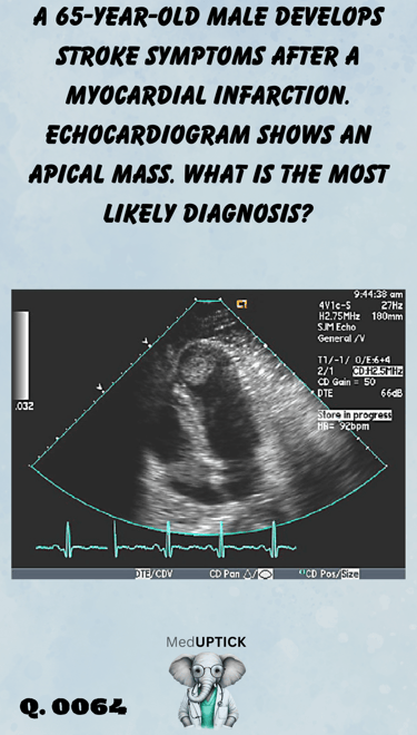 an echocardiogram image displaying an apical mass