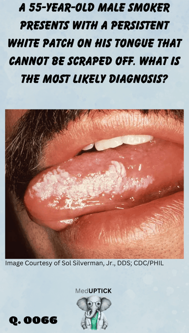 a male with a white lesion on the lateral side of his tongue
