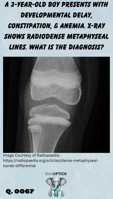 an x-ray of the knee with radiodense metaphyseal lines of a toddler