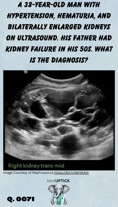 bilaterally enlarged kidneys on ultrasound