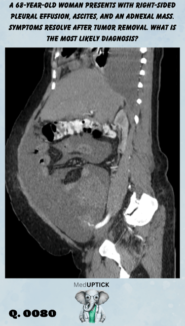 a sagital CT scan image demonstrating abdominal ascites