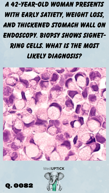 a histology slide showing signet ring cells