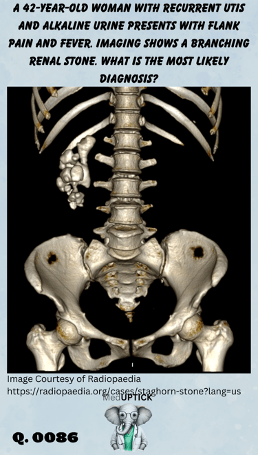 a 3-D image of a skeleton and a calcified kidney stone