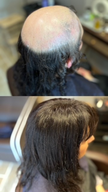 Complément capillaire femme