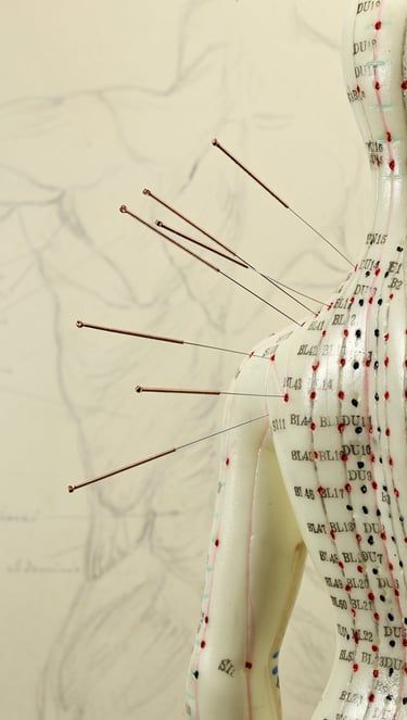 Image of acupuncture needles and figurine showing acupuncture points