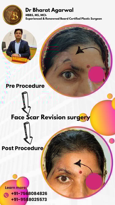 Dr. Bharat Agarwal, best plastic surgeon in Udaipur, conducting expert review for facelift surgery