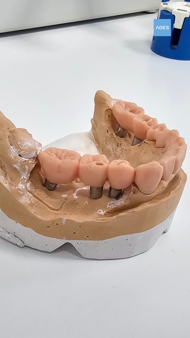 Clínica Dental ADES: implantes en Badajoz