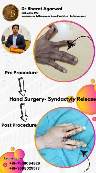 Hand and Microvascular Surgery in udaipur.
