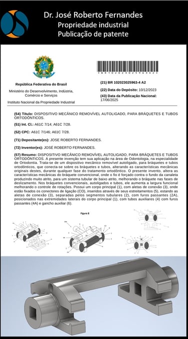 O acessório Ortodôntico mais eficiente é o DIMERA do Dr. José Roberto Fernandes