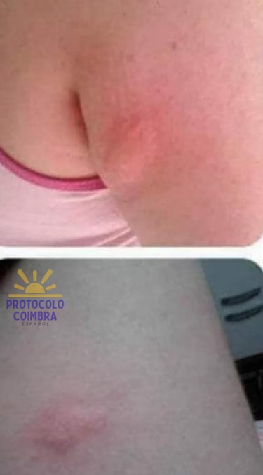 Fotos con efectos secundarios del medicamento convencional.