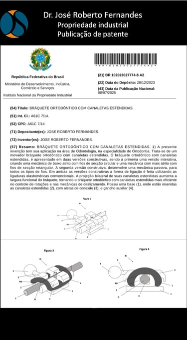 O aparelho ortodôntico mais eficiente é o Arquimedes System do Dr. José Roberto Fernandes