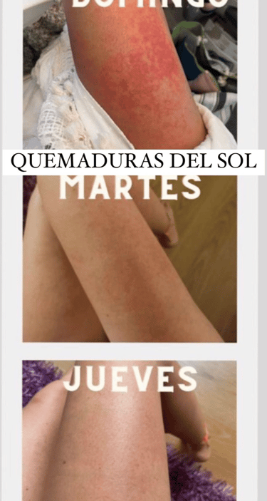 a woman with a red spot on her leg and a picture of a woman without