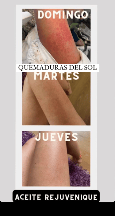 a woman with a red spot on her leg and a picture of a woman without