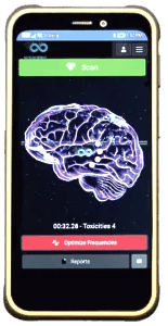 a smartphone phone showing a brain scang - like brain scang