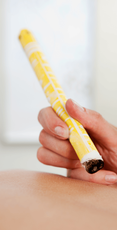 Séance de médecine chinoise, pratique du Moxa