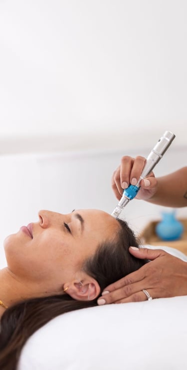 Microneedling in Temecula California